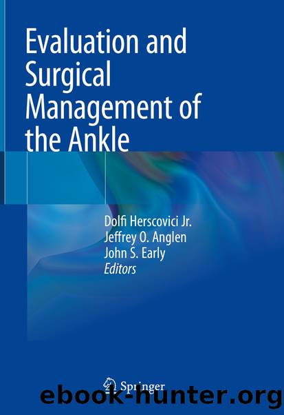 Evaluation and Surgical Management of the Ankle by Unknown