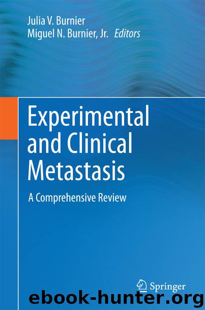 Experimental and Clinical Metastasis by Julia V. Burnier & Miguel N. Burnier Jr