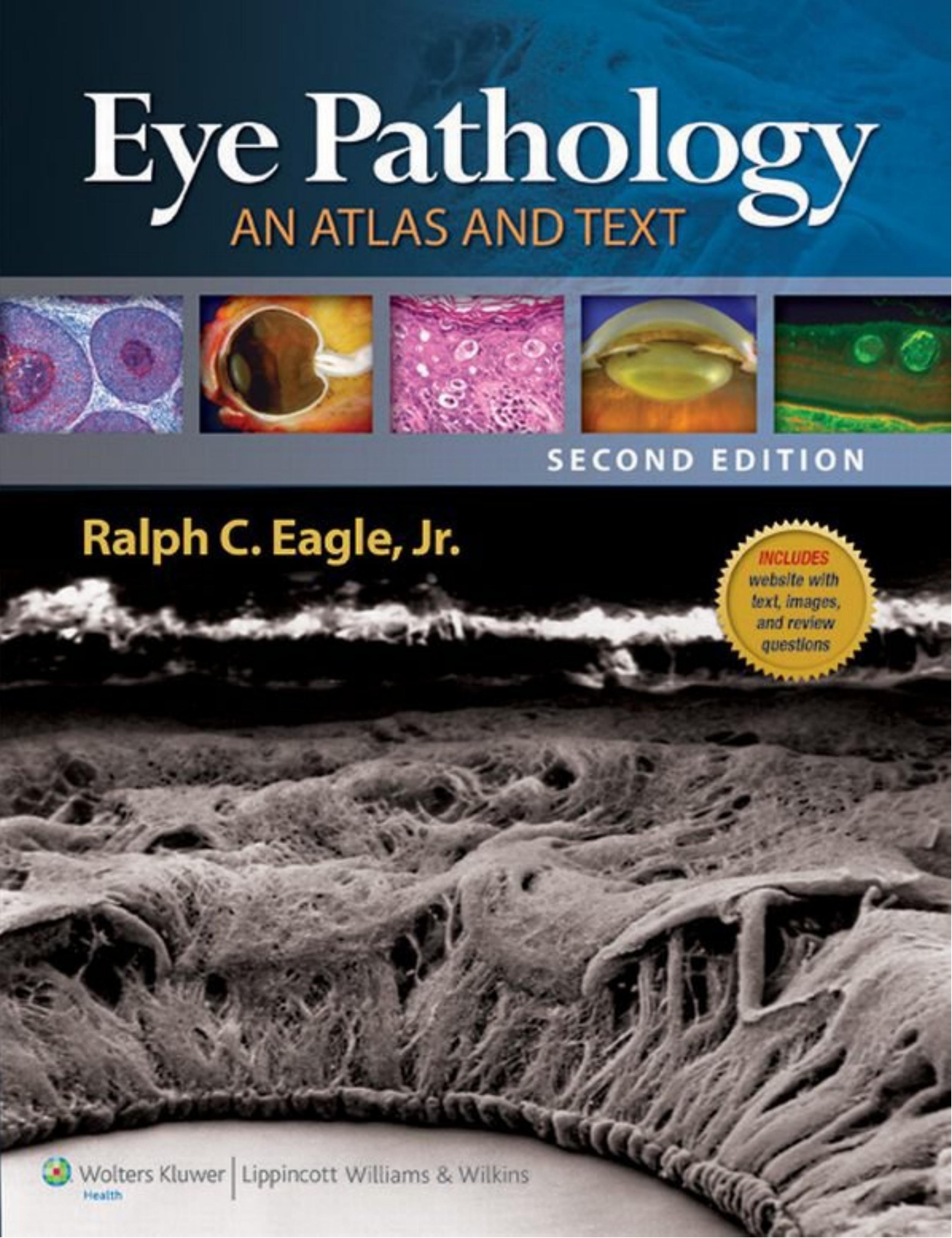 Eye Pathology: An Atlas and Text by Ralph C. Eagle MD