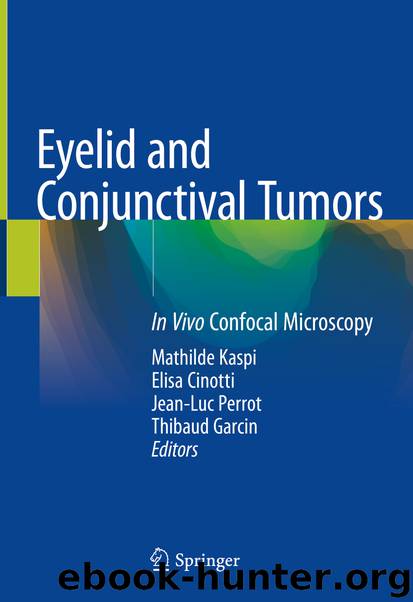 Eyelid and Conjunctival Tumors by Unknown