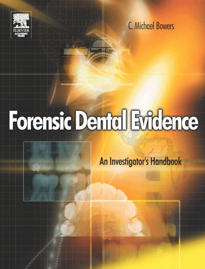 FORENSIC DENTAL EVIDENCE: AN INVESTIGATORâS HANDBOOK, First Edition by C. Michael Bowers