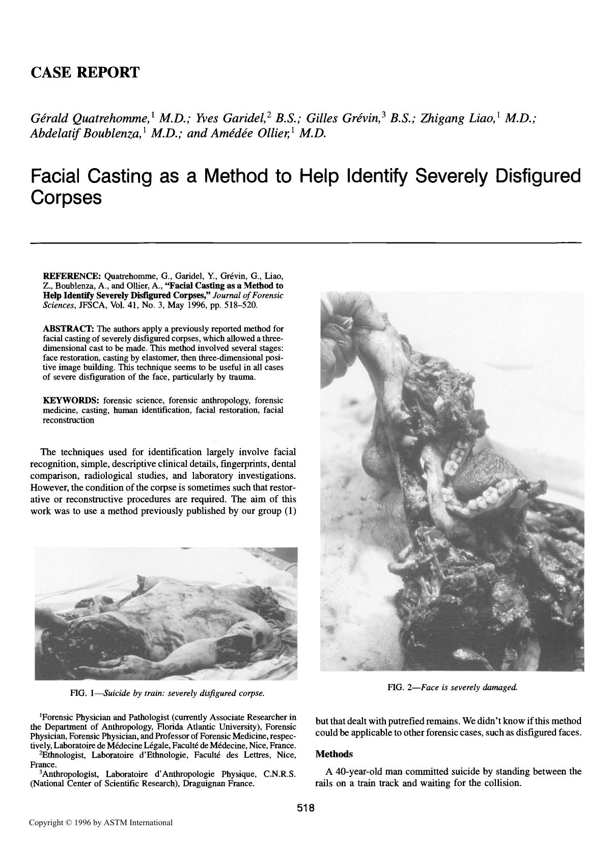 Facial Casting as a Method to Help Identify Severely Disfigured Corpses by Quatrehomme G Garidel Y Gr & eacute;vin G Liao Z Boublenza A Ollier A
