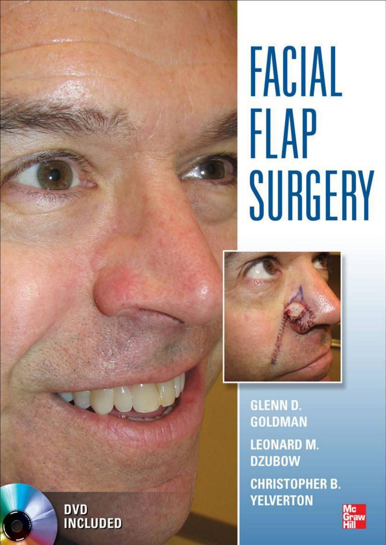 Facial Flaps Surgery by Glenn Goldman Leonard Dzubow Christopher Yelverton