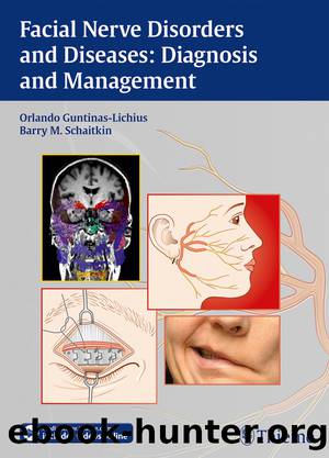 Facial Nerve Disorders and Diseases: Diagnosis and Management by Guntinas-Lichius Orlando;Schaitkin Barry M.;
