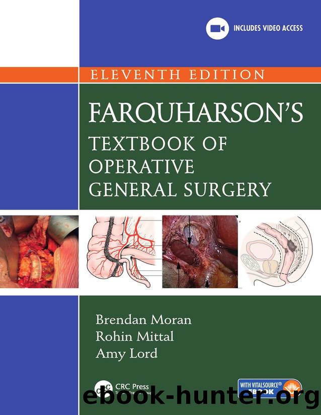 Farquharsonâs: Textbook of Operative General Surgery by Brendan Moran & Rohin Mittal & Amy Lord