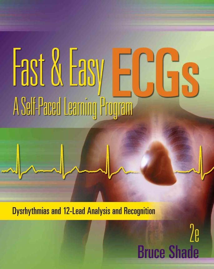 Fast & easy ECGs : a self-paced learning program by Shade Bruce R