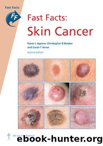 Fast Facts: Skin Cancer by unknow