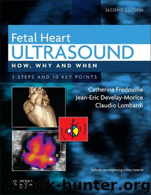 Fetal Heart Ultrasound: How, Why and When by Fredouille Catherine & Develay-Morice Jean-Eric & Lombardi Claudio