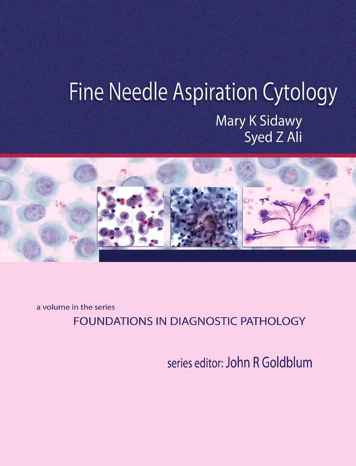 Fine Needle Aspiration Cytology: A Volume in Foundations in Diagnostic Pathology by Mary K. Sidawy (ed.) Syed Z. Ali (ed.)