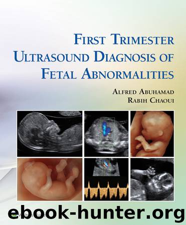 First Trimester Ultrasound Diagnosis of Fetal Abnormalities by Alfred Abuhamad & Rabih Chaoui