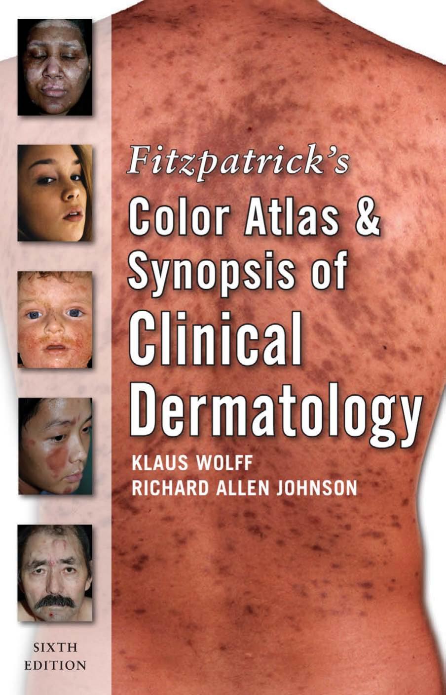 Fitzpatrick Color Atlas and Synopsis of Clinical Dermatology (Fitzpatrick's Color Atlas & Synopsis of Clinical Dermatology) by R. Johnson