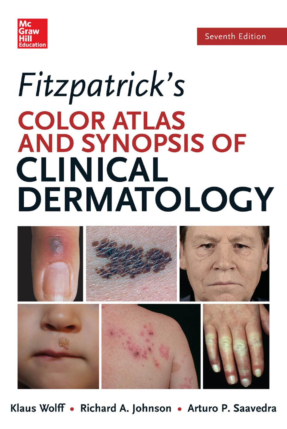 Fitzpatrickâs Color Atlas and Synopsis of Clinical Dermatology by Klaus Wolff MD FRCP