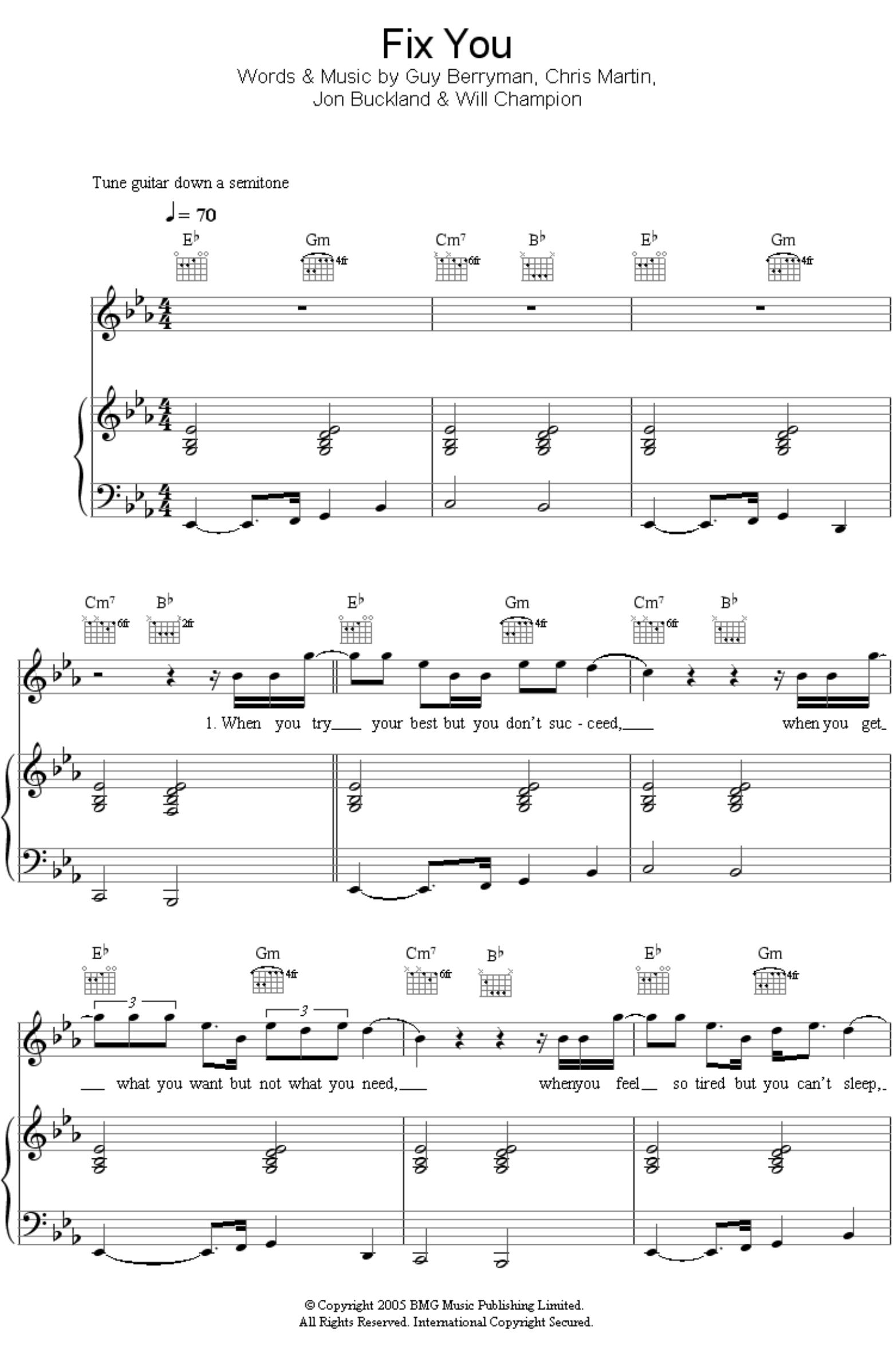 Fix You by Coldplay