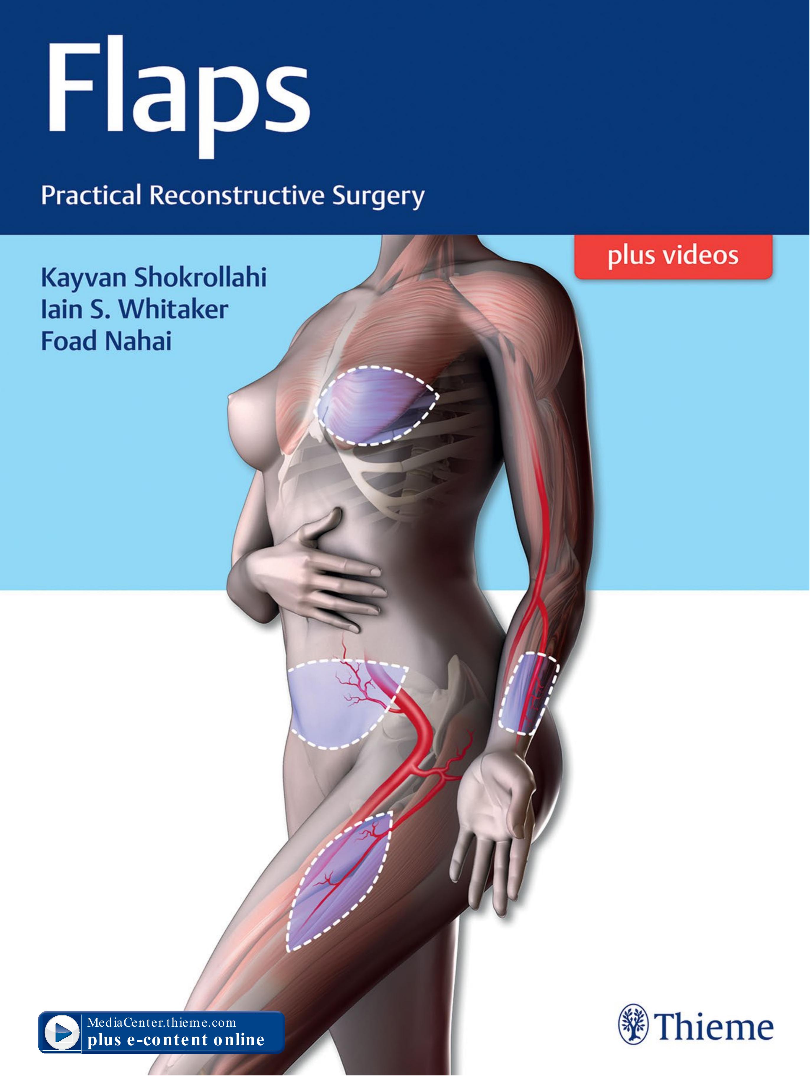Flaps : practical reconstructive surgery by Shokrollahi Kayvan; Whitaker Iain S.; Nahai Foad