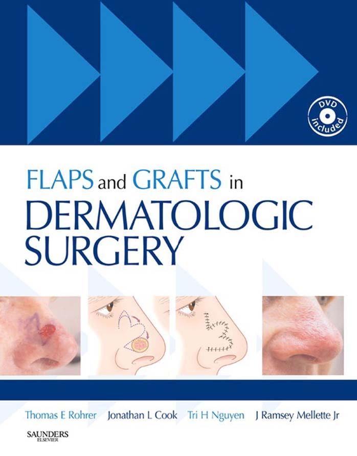 Flaps and Grafts in Dermatologic Surgery: Text with DVD by Thomas E. Rohrer MD Jonathan L. Cook MD Tri H. Nguyen MD