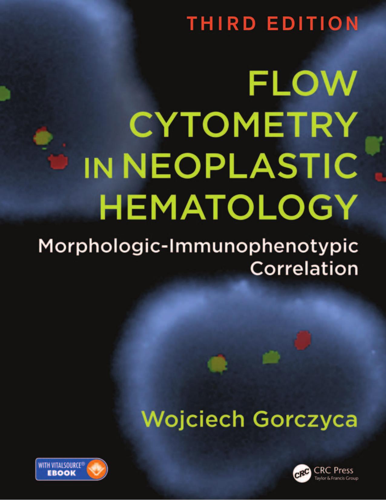 Flow Cytometry in Neoplastic Hematology by Gorczyca Wojciech