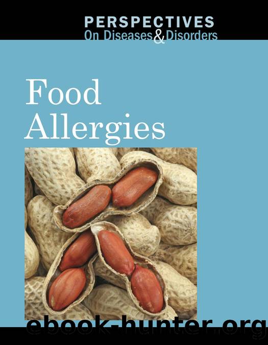 Food Allergies by Gillard Arthur;