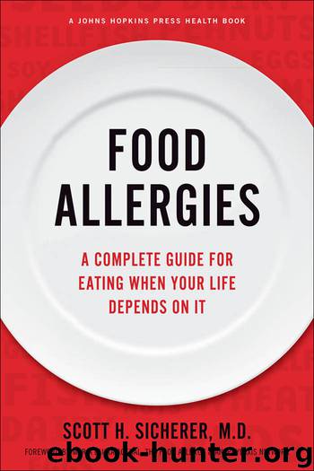 Food Allergies by Scott H. Sicherer