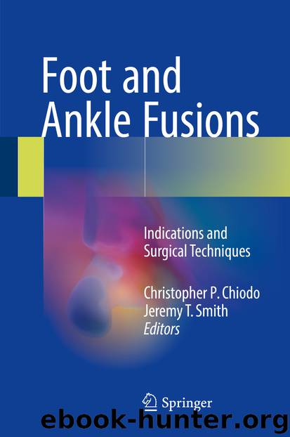 Foot and Ankle Fusions by Christopher P. Chiodo & Jeremy T. Smith