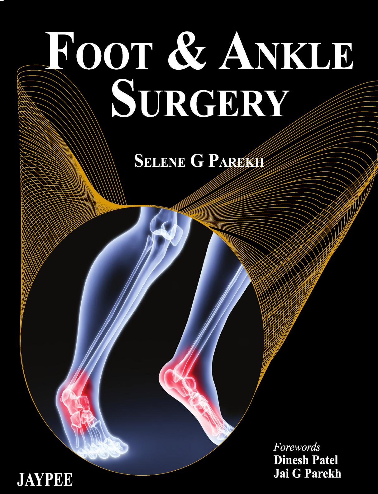 Foot and Ankle Surgery by Selene Parekh