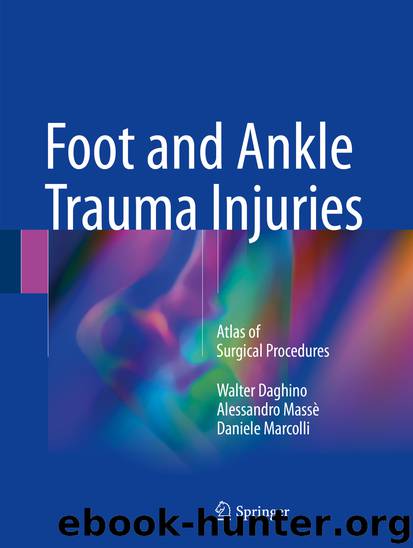 Foot and Ankle Trauma Injuries by Walter Daghino Alessandro Massè & Daniele Marcolli