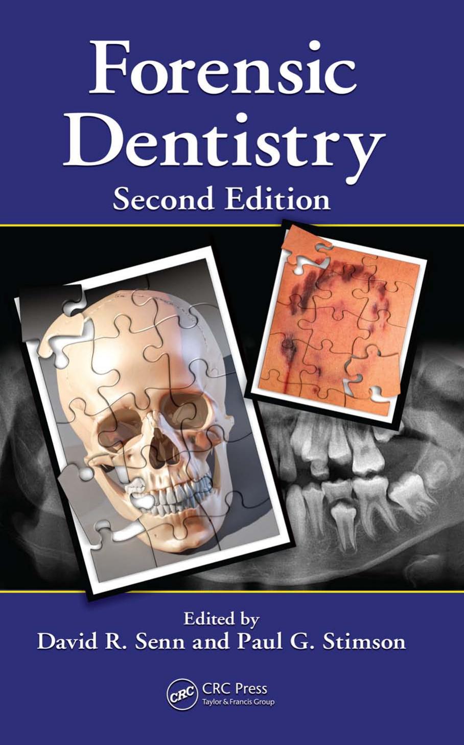 Forensic Dentistry, Second Edition by David R. Senn Paul G. Stimson
