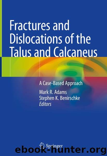 Fractures and Dislocations of the Talus and Calcaneus by Mark R. Adams & Stephen K. Benirschke