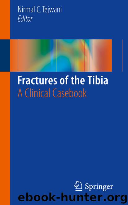 Fractures of the Tibia by Nirmal C. Tejwani