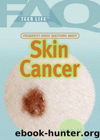 Frequently Asked Questions About Skin Cancer by John M. Shea