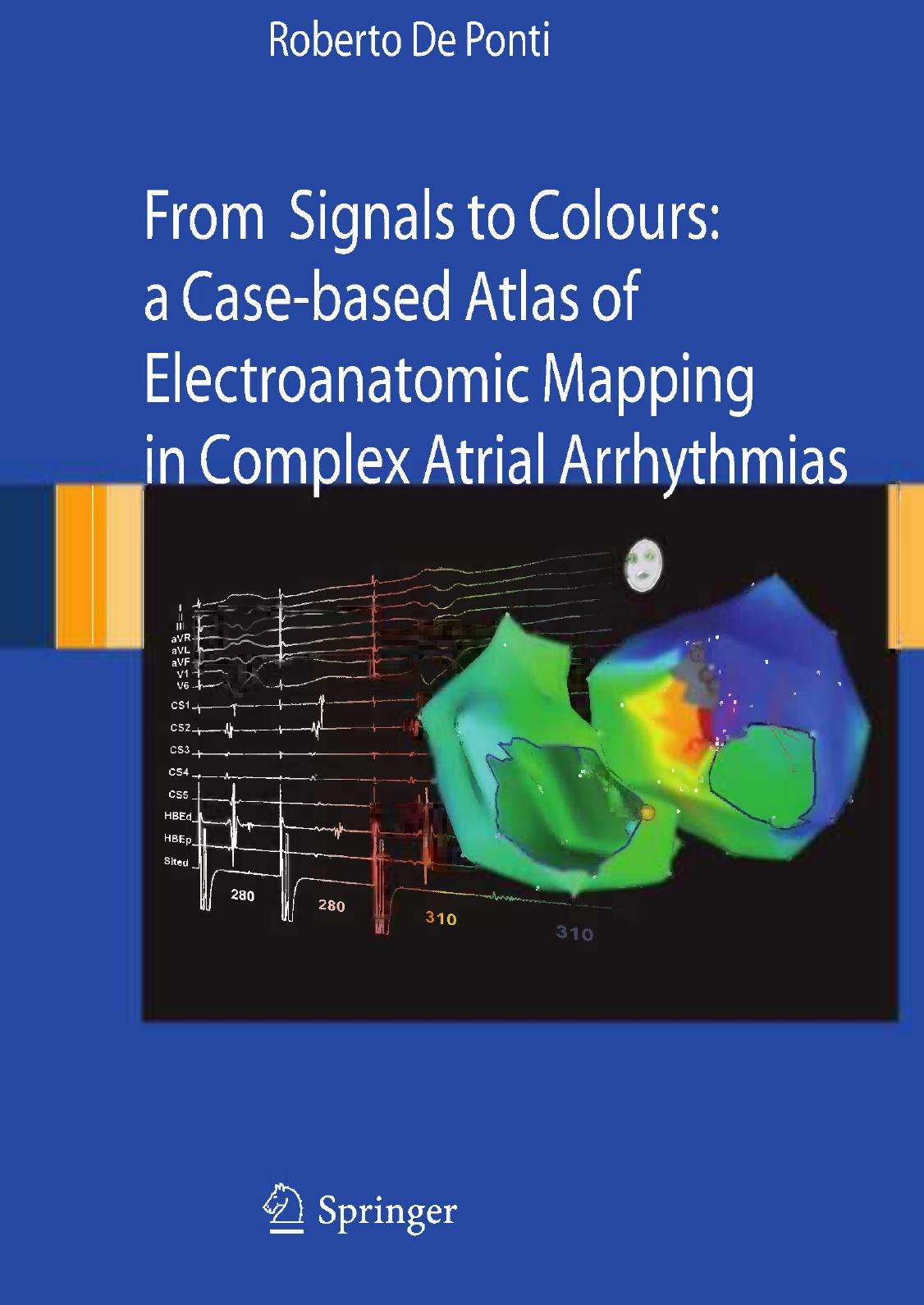 From Signals to Colours: A Case-based Atlas of Electroanatomic Mapping in Complex Atrial Arrhythmias by Roberto De Ponti (auth.)