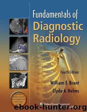 Fundamentals of Diagnostic Radiology: 1 by William E Brant & Clyde Helms