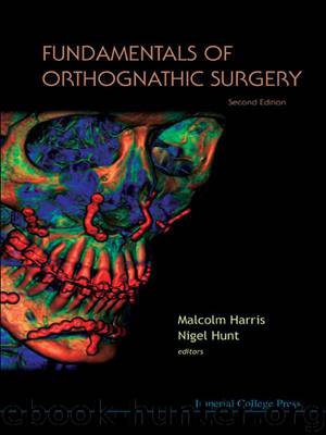 Fundamentals of Orthognathic Surgery (2nd Edition) by Harris Malcolm & Hunt Nigel