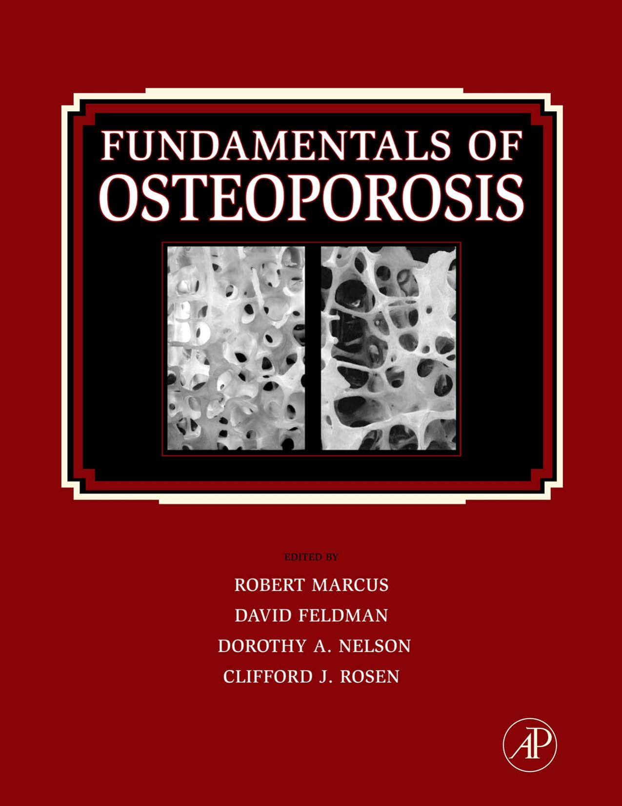 Fundamentals of Osteoporosis by Marcus Robert & Robert
