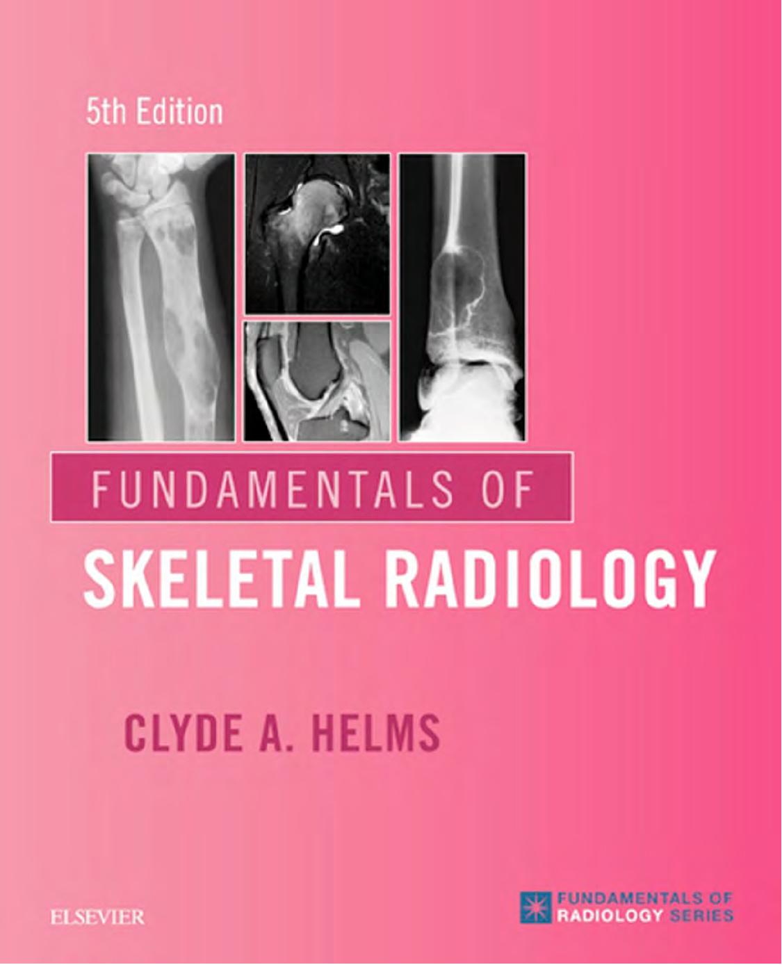 Fundamentals of Skeletal Radiology by Clyde A. Helm