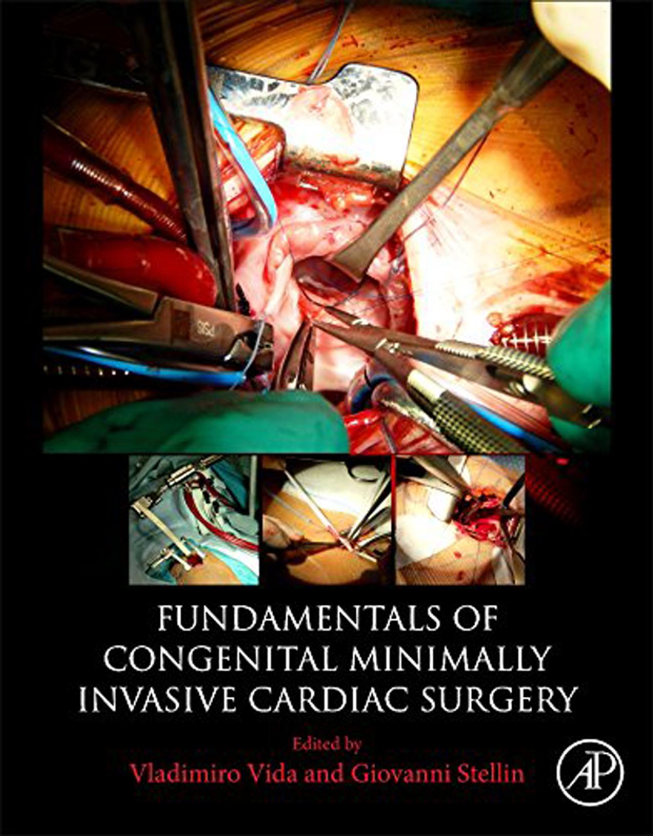 Fundamentals of congenital minimally invasive cardiac surgery by Stellin Giovanni; Vida Vladimiro L