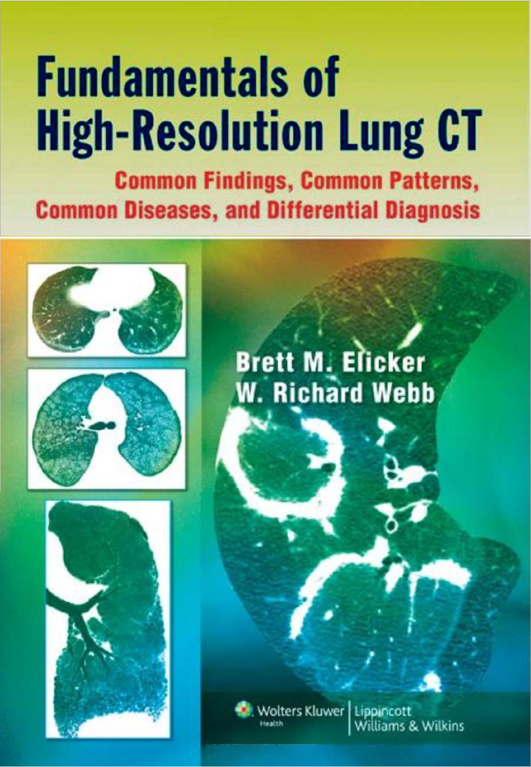 Fundamentals of high-resolution lung CT: common findings, common patterns, common diseases, and differential diagnosis by Elicker Brett M.; Webb Wayne Richard