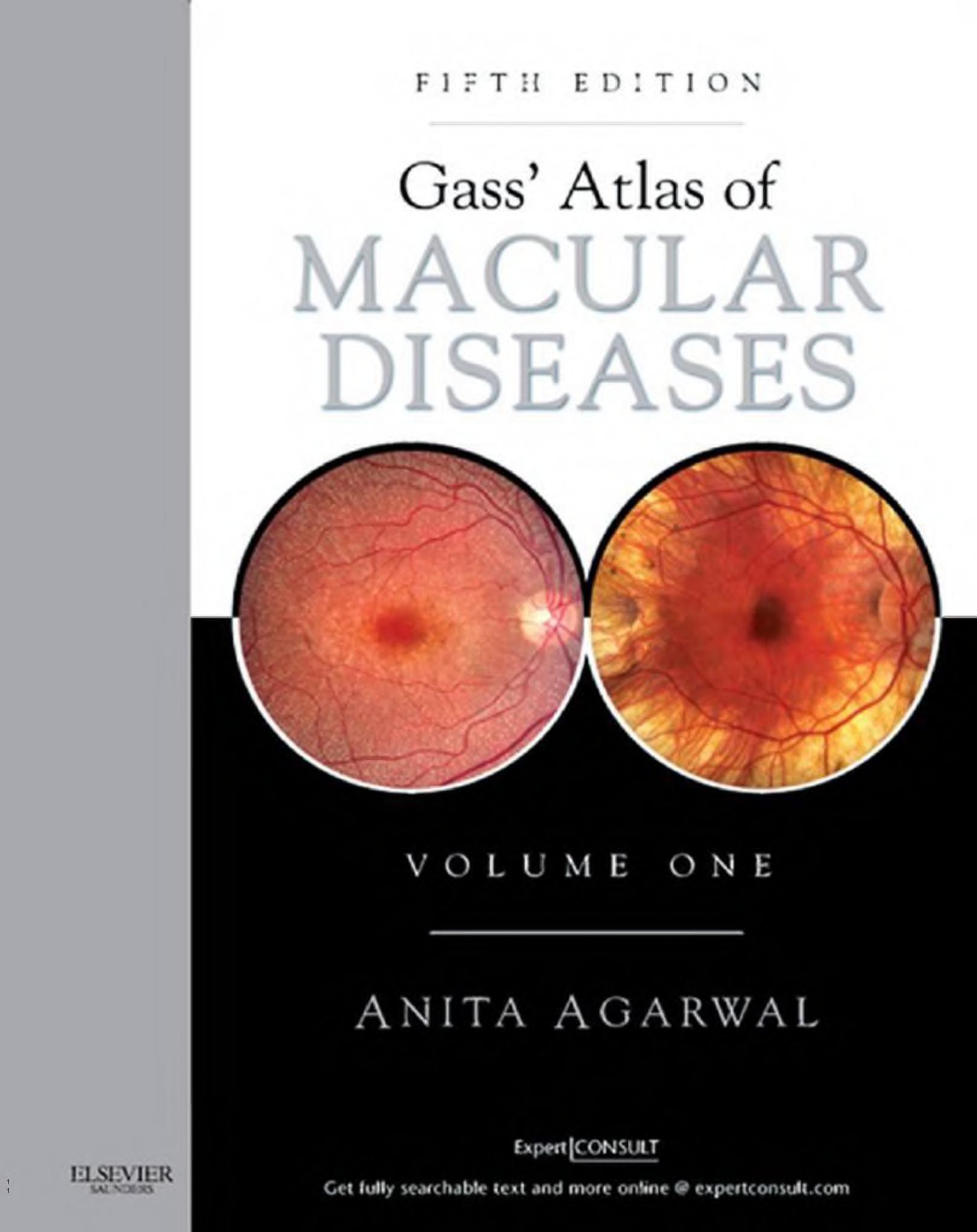 Gassâ Atlas of Macular Diseases by Anita Agarwal