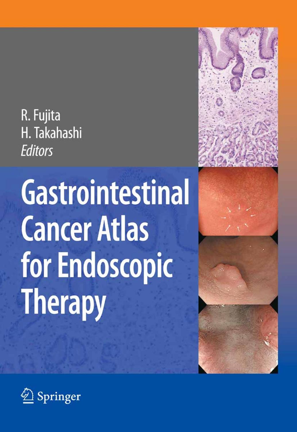 Gastrointestinal Cancer Atlas for Endoscopic Therapy by Rikiya Fujita Hiroshi Takahashi