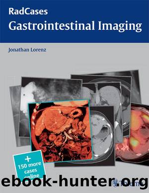 Gastrointestinal Imaging (Radcases) by Lorenz Jonathan