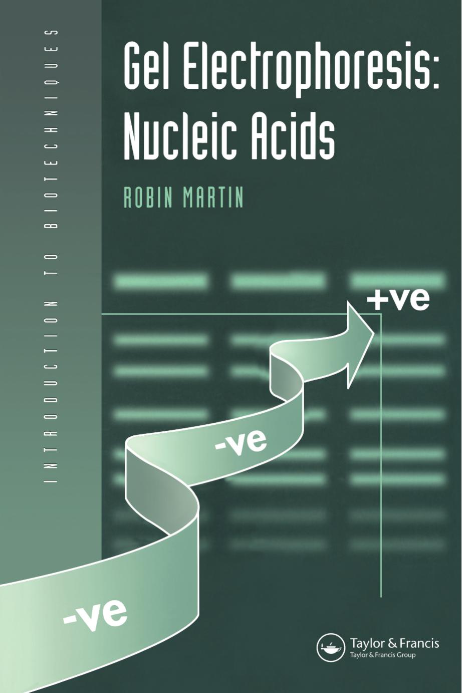 Gel electrophoresisds nucleic acids by Martin Robin