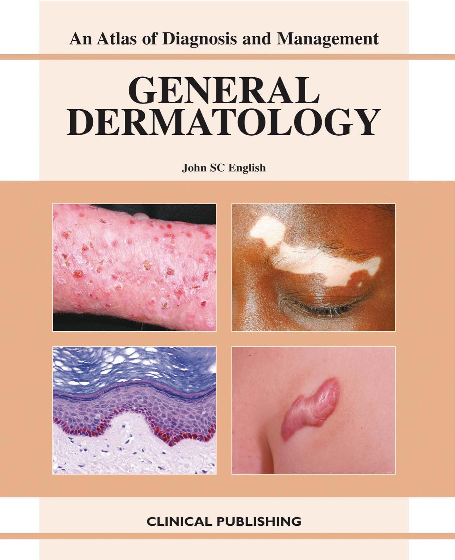 General Dermatology: An Atlas of Investigation and Management by John S. C. English