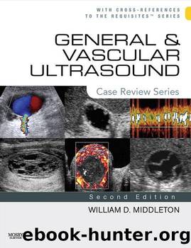General and Vascular Ultrasound: Case Review Series by Middleton William D