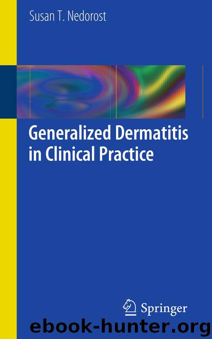 Generalized Dermatitis in Clinical Practice by Susan T. Nedorost
