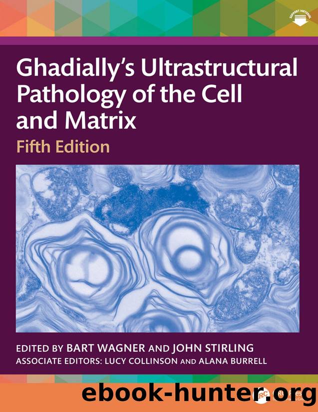 Ghadiallyâs Ultrastructural Pathology of the Cell and Matrix by Bart Wagner & John Stirling