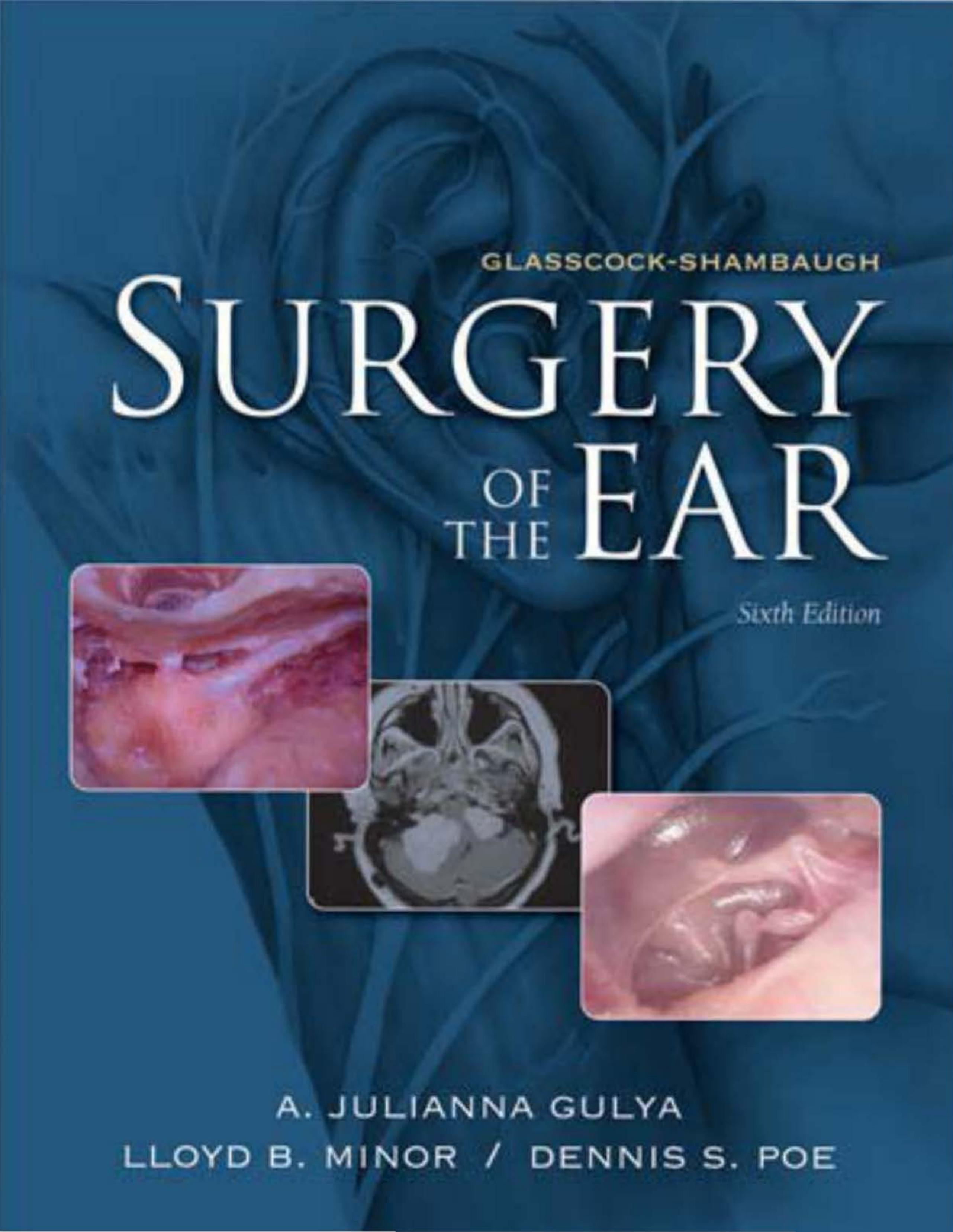 Glasscock-Shambaugh Surgery of the Ear by A. Julianna Gulya Lloyd B. Minor Dennis S. Poe