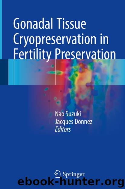Gonadal Tissue Cryopreservation in Fertility Preservation by Nao Suzuki & Jacques Donnez