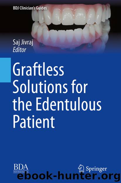Graftless Solutions for the Edentulous Patient by Saj Jivraj
