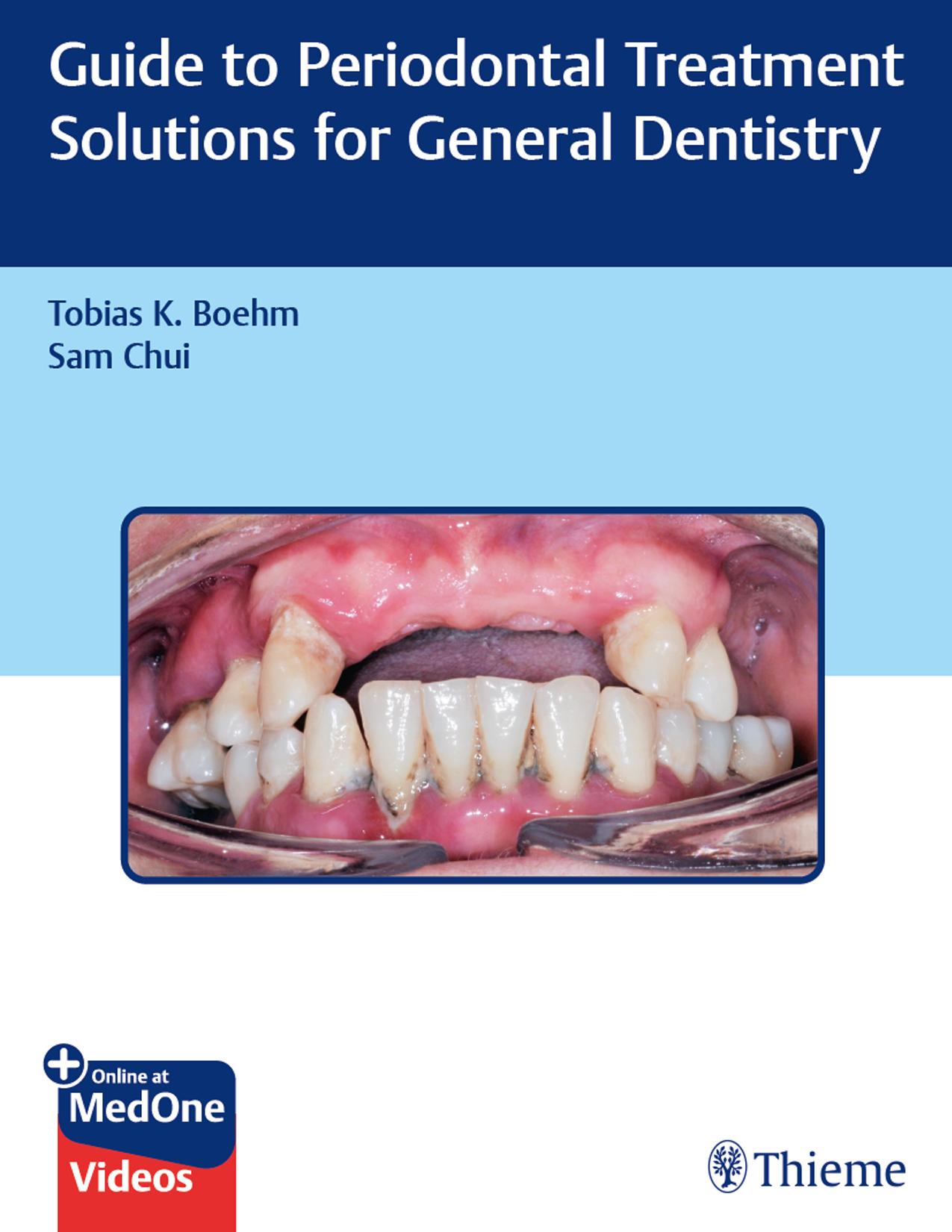Guide to Periodontal Treatment Solutions for General Dentistry Illustrated Edition by Unknow