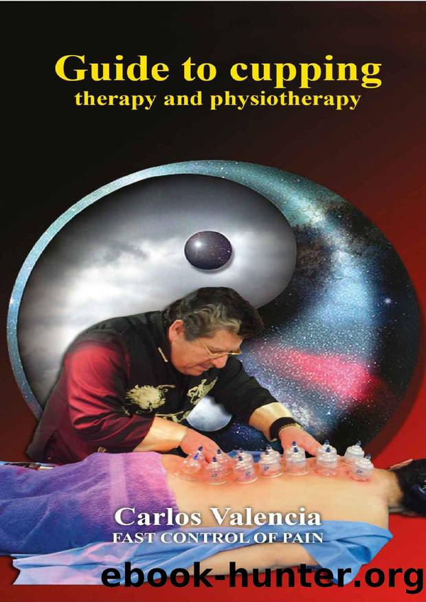 Guide to cupping therapy and phytotherapy: fast pain management by Carlos Valencia