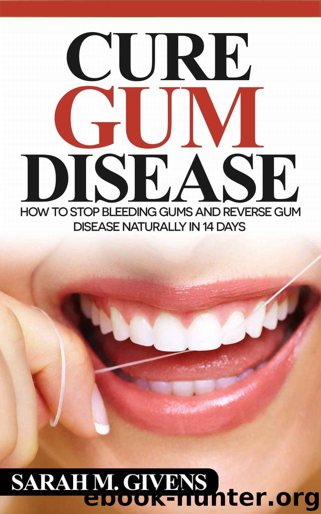 Gum Disease Cure (Gum Disease Cure, Periodontal Disease, Gum Disease, Gum Infection, Gingivitis treatment, Tooth Decay) by Sarah M. Givens